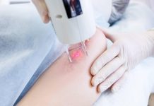 Лазерная шлифовка шрамов — путь к безупречной коже