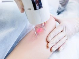 Лазерная шлифовка шрамов — путь к безупречной коже