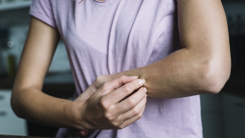 Названы три признака, которые могут указать на рак кожи