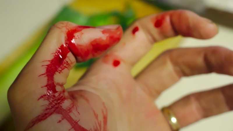 Окровавленный житель Колпино с сильнейшим похмельем попал в реанимацию